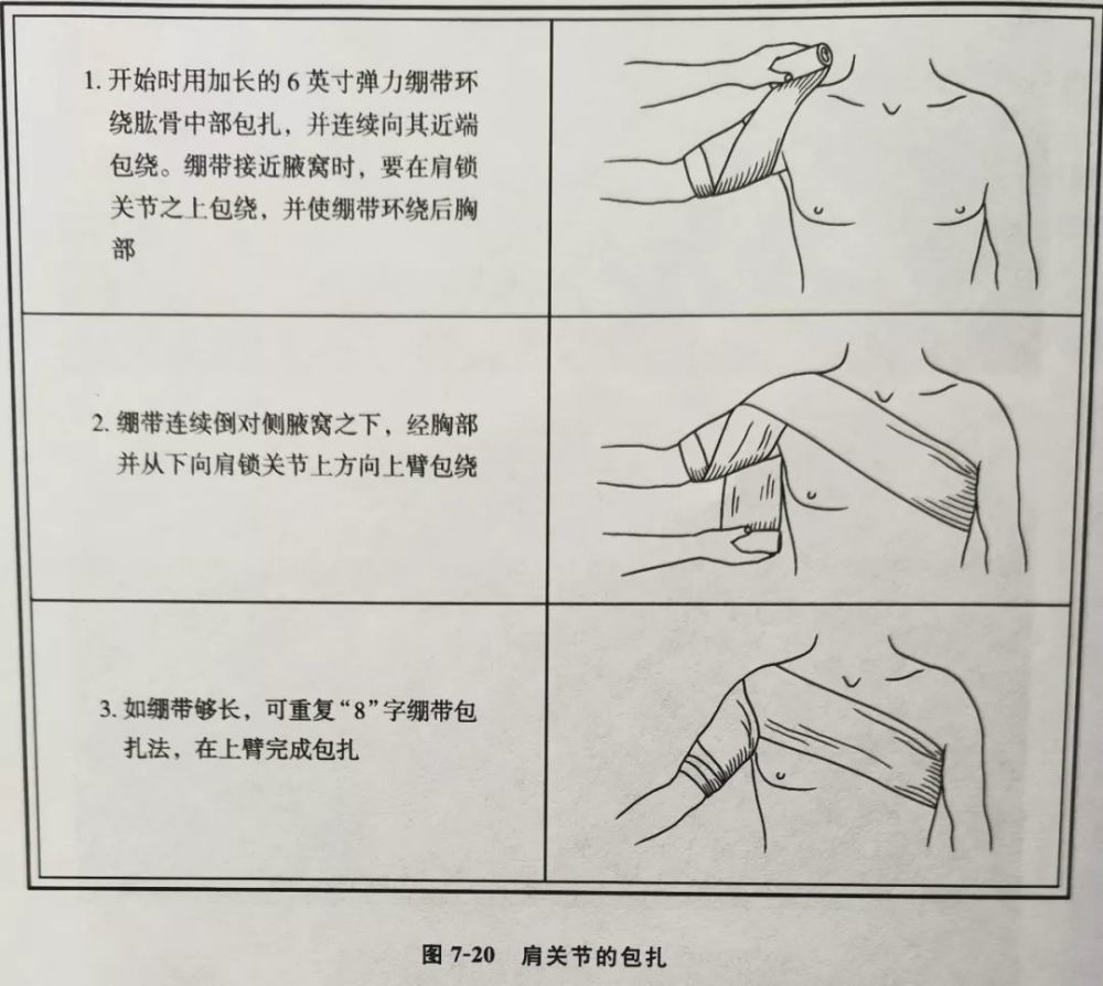 三角绷带可以用来包扎肩部的伤口(图7-21)