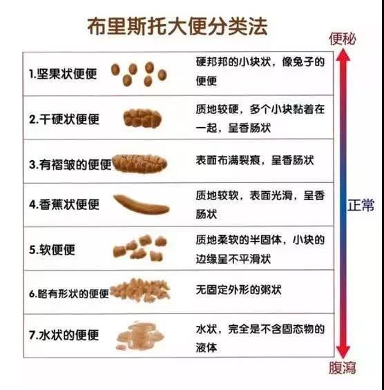 从大便形状看肠道健康:对照5个特点,排除疾病可能