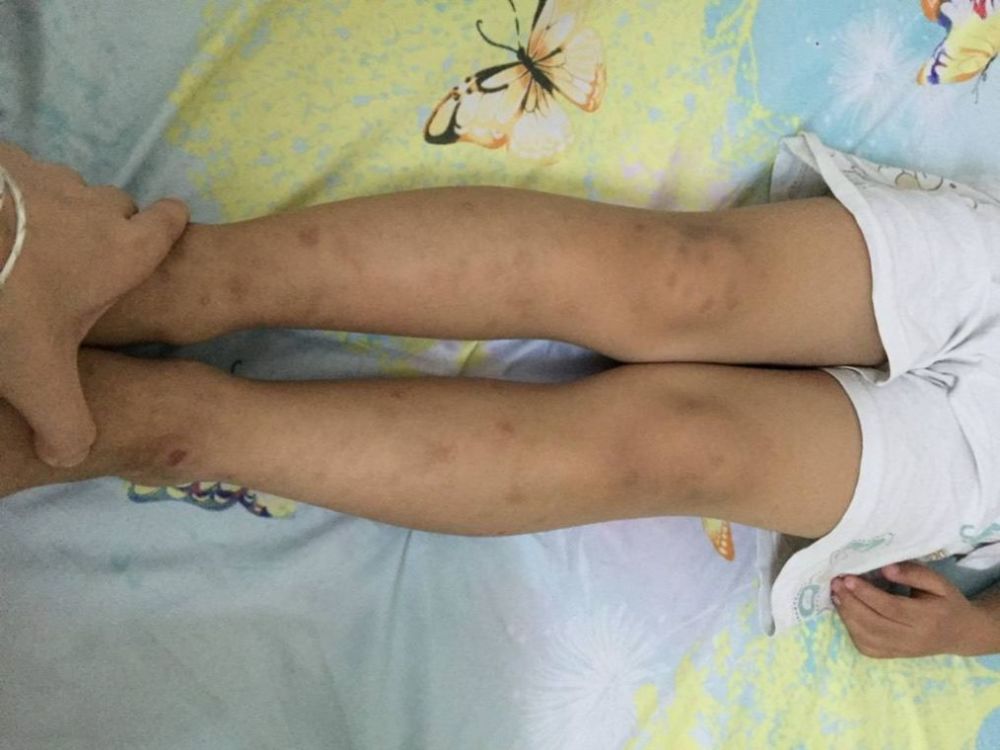 担心孩子长大腿型不好,x型腿o型腿,这些小方法可轻松预防