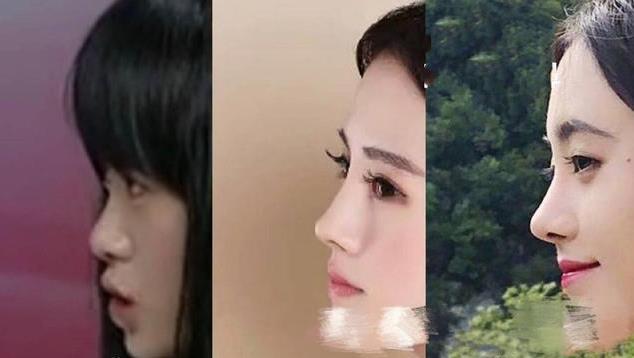 从山根来看,鞠婧祎以前的鼻子还算小巧可爱,放在普通人中也是清秀脸