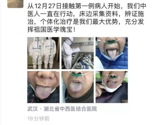 从舌苔判断自己是否为新型冠状病毒易感人群