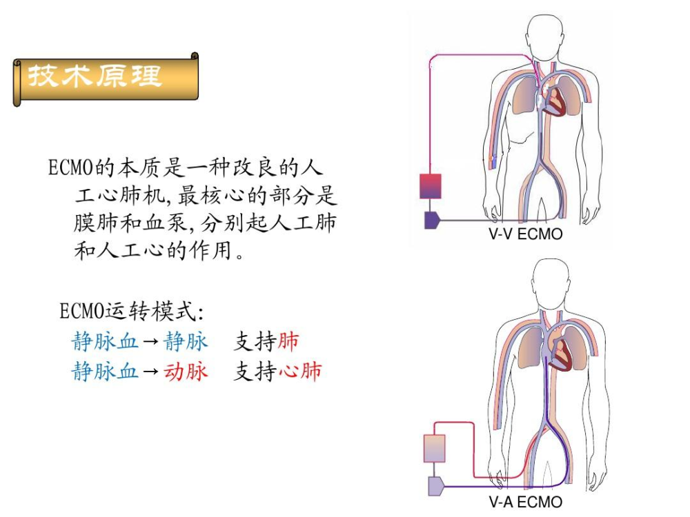 科普:"救命神器"ecmo到底是什么?