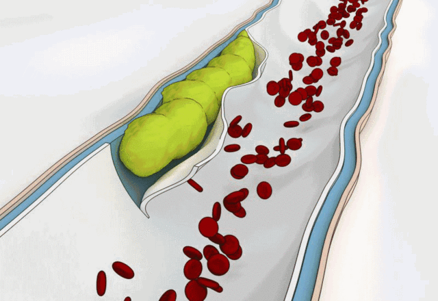 蛋黄高脂肪,高胆固醇不能吃?