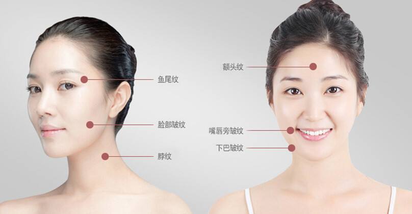 脸型下半部的循环变差,脸色开始变得暗沉,原先挺括的下颚也变得松垮