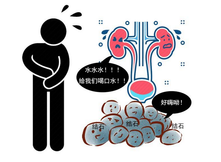 泌尿系统结石