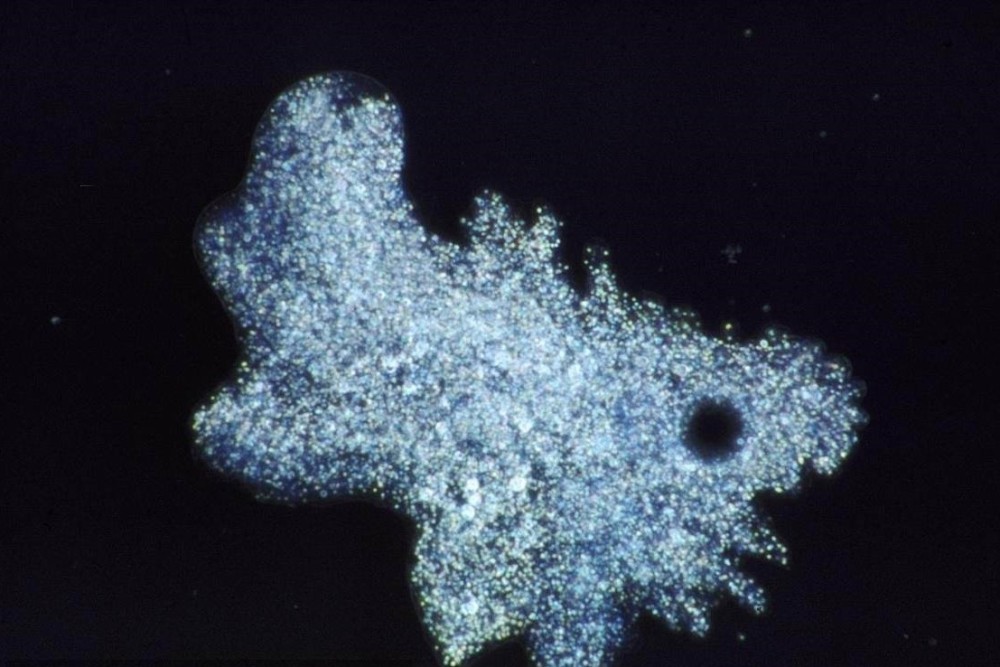 噬菌体,阿米巴,大肠杆菌