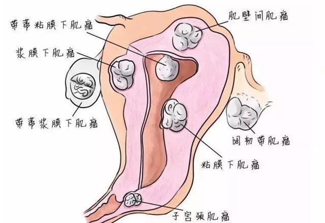 子宫,子宫内膜,细胞,孕激素