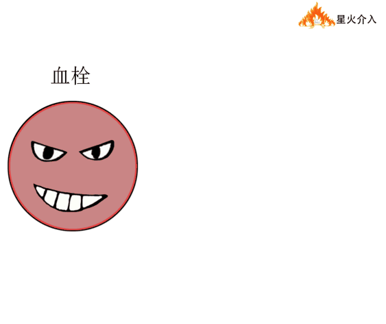 肺部血栓解决后,医生会在患者的下腔静脉,放置一个滤网.