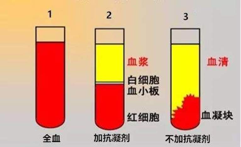 新冠病毒肺炎的血浆疗法是什么?它可靠吗?