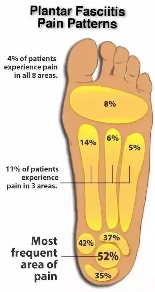 脚跟疼,像踩着钉子一样,4个动作帮你缓解"足底筋膜炎"