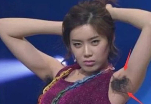 为何有的女生腋下"不长毛"?89%是这3原因,这些是羡慕不来的!
