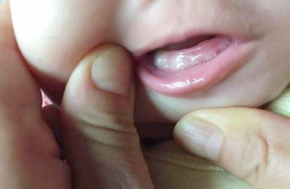 宝宝牙齿发黄,杂乱,缝隙大?影响因素有很多,家长需提前知晓