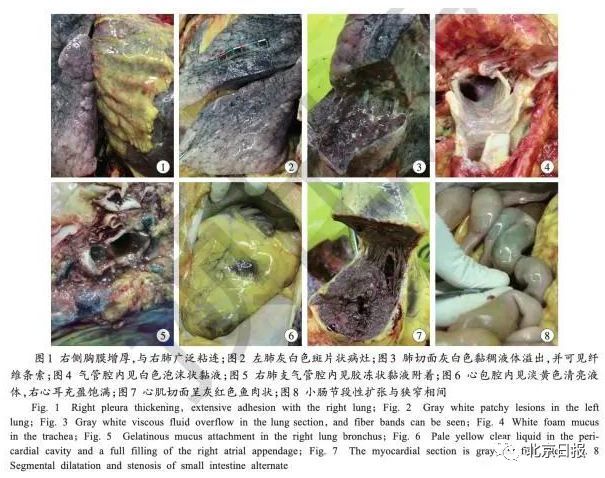 全国首份新冠肺炎遗体解剖报告,有这些重大发现!