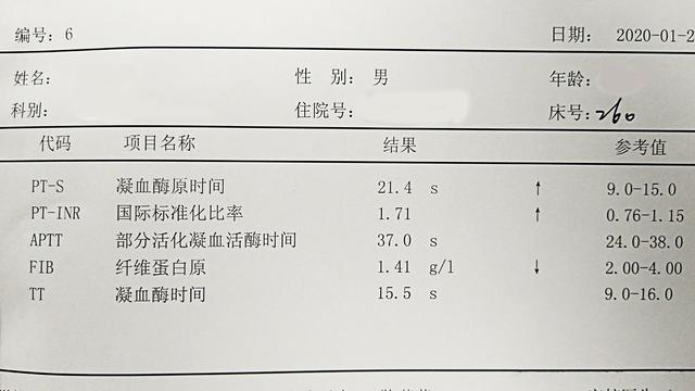 转氨酶轻度升高或正常,ast/alt>1,肝癌时ast/alt≥3.