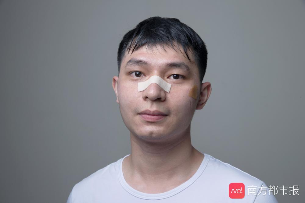 李嘉伟广东药科大学附属第一医院 重症医学科护士