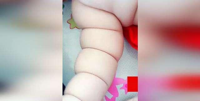 妈妈生下"莲藕宝宝",婆婆正为这大胖小子得意,医生却连连叹气