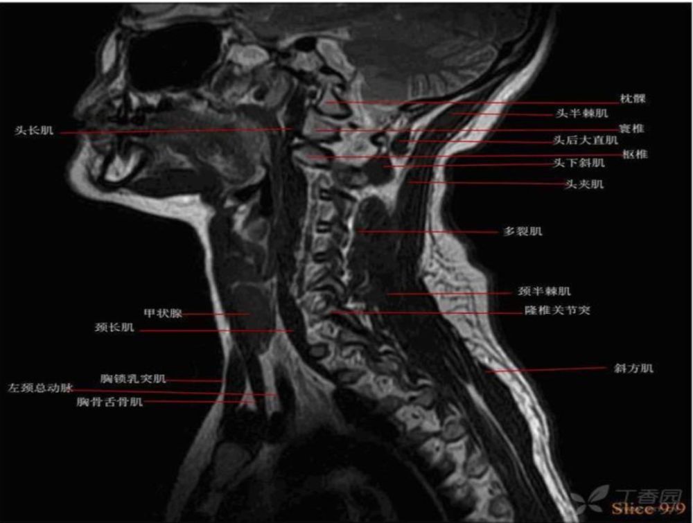 正常脊柱 mri 图谱,你一定不能错过!