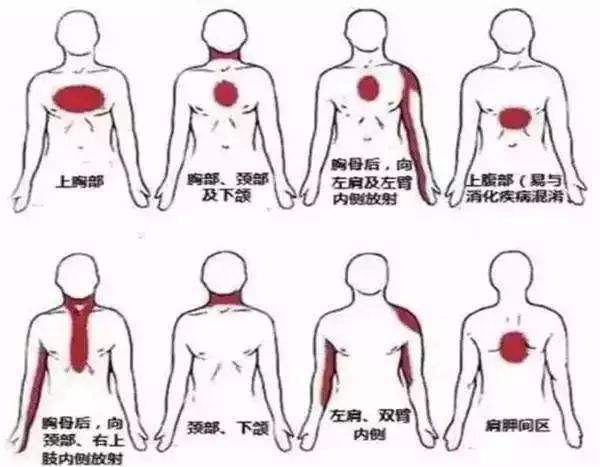 20岁女生心电图提示心肌缺血!这可怎么办?医生看完她放心了!