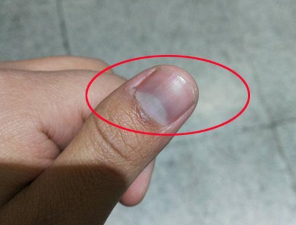 手指甲根部的"月牙白",如果变多了意味着什么?很多人都不知道