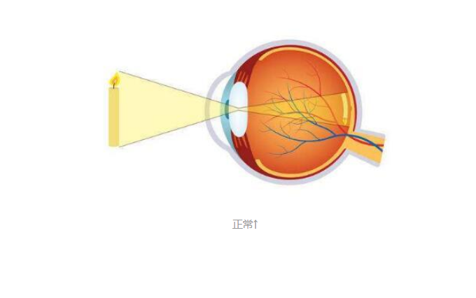 近视和远视的人,看到的世界是怎样?网友:还是正常人