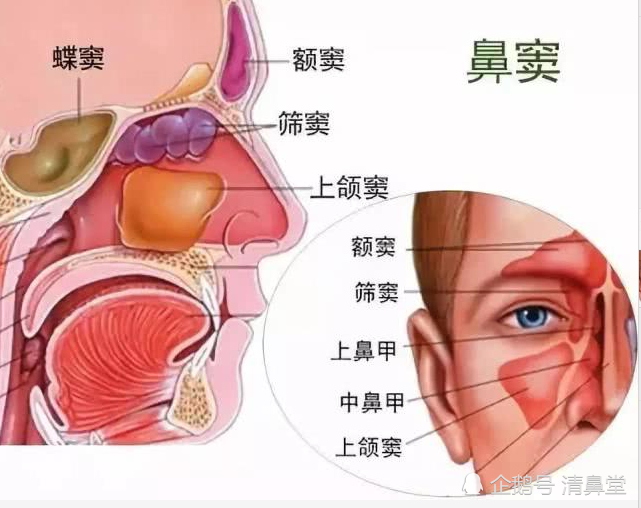 清鼻堂:鼻窦炎可导致这些眼部疾病 鼻窦炎可引起急性或慢性结膜炎