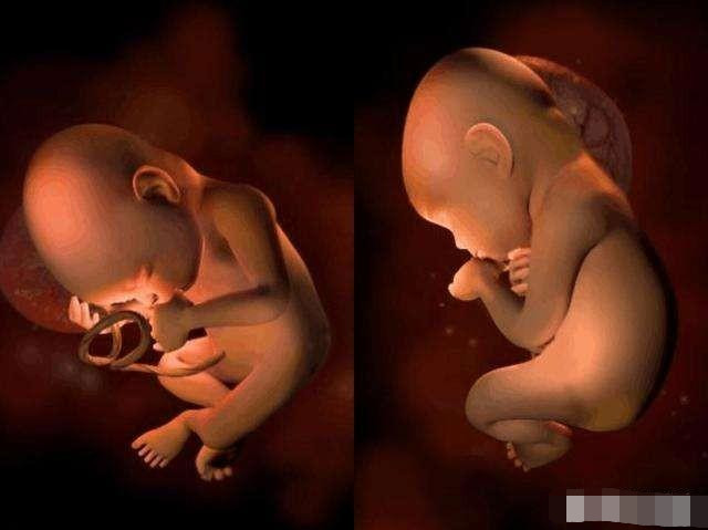 胎儿,孕妇,孕期,孕妈,孕妈咪,孕晚期