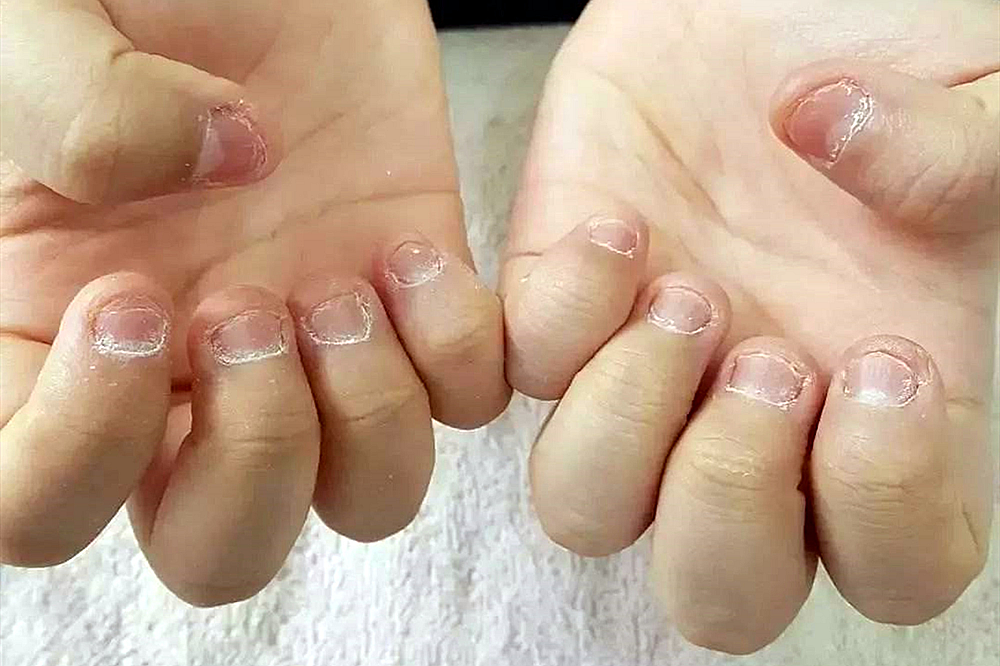 宝宝为什么会咬手指,啃指甲呢?