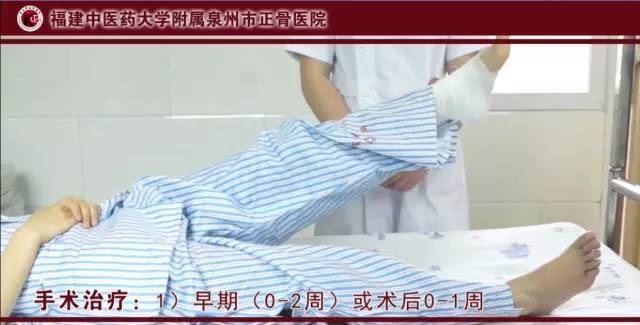 谈谈跟骨骨折那些事