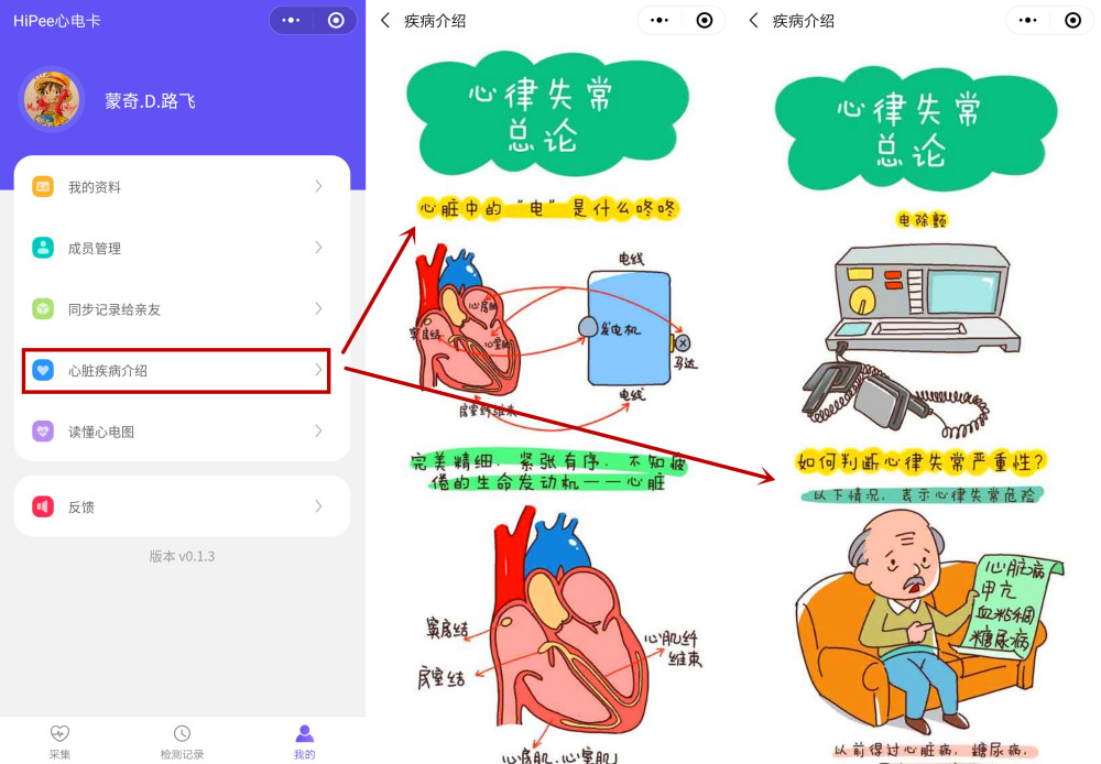 三甲医院权威认定,hipee心电记录仪,你身边的心脏健康