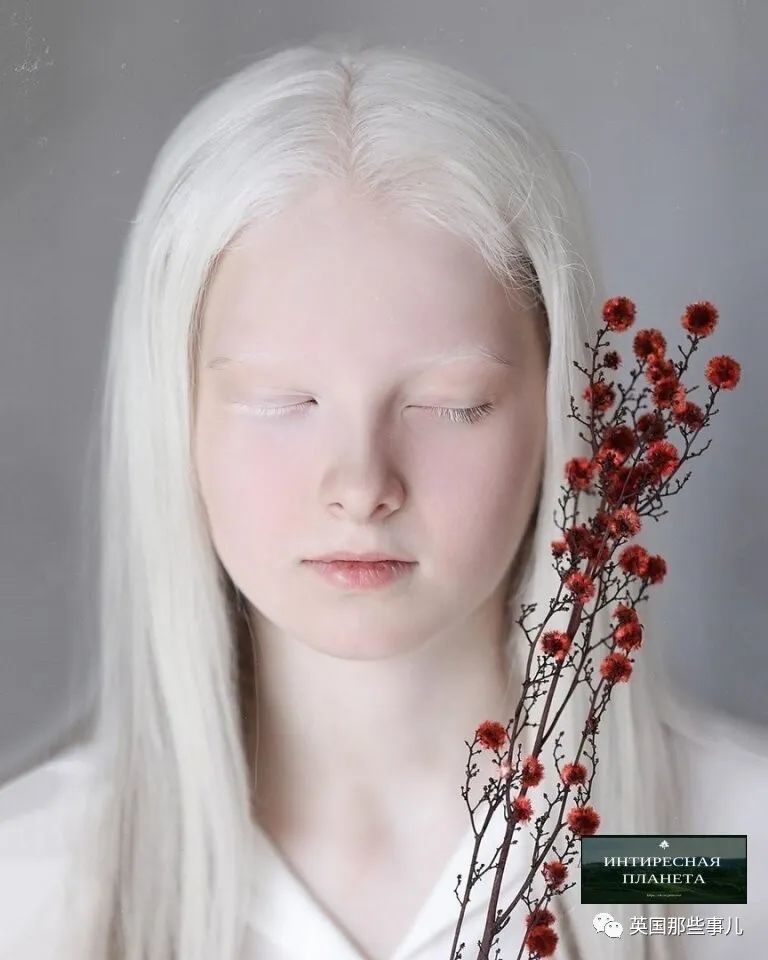 一眼冰雪,一眼森林…这个白化病 异色瞳的俄罗斯少女让网友震惊了