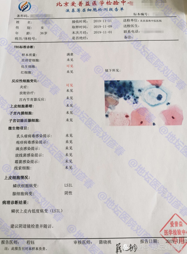 hpv,宫颈癌,hpv疫苗,尖锐湿疣