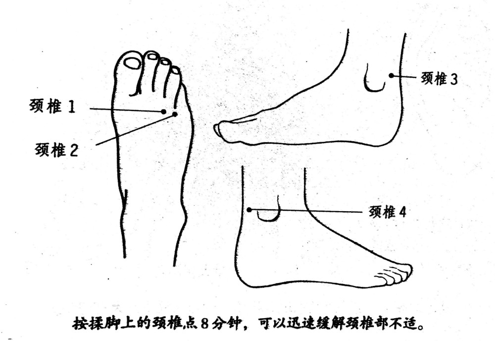 颈椎病,久坐职业病,养生,中医健康,落枕