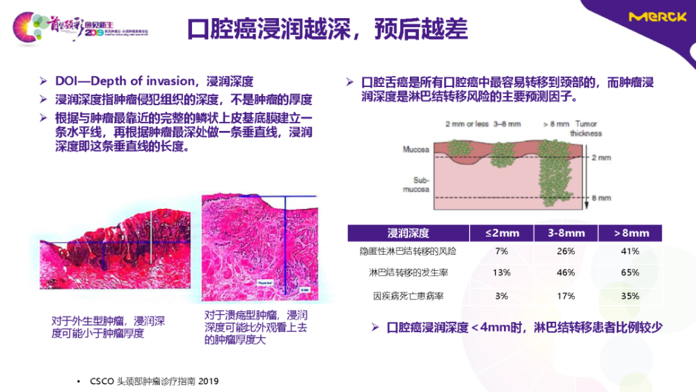 了最新的第八版uicc/ajcc37tnm分期系统,增加了口腔癌doi作为分期标准