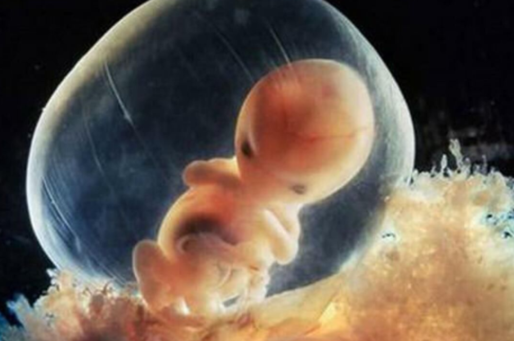 胚胎移植,保胎,试管,子宫
