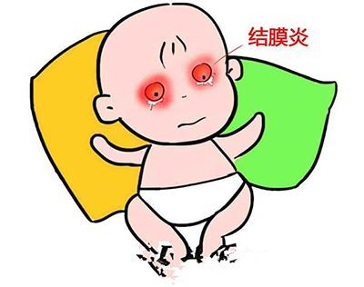 眼睛突然红肿,发痒,是什么作怪?医生:或是过敏性结膜炎,别忽视