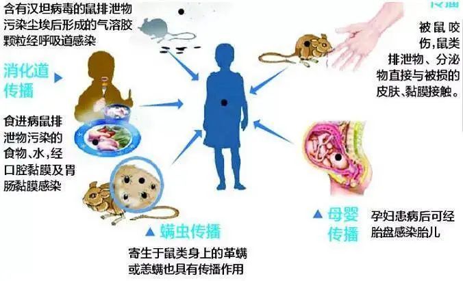 正确认识,科学防治——关于流行性出血热