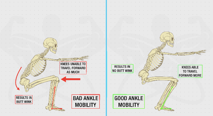 到达髋关节折叠的极限后,想要要继续下蹲,骨盆就不得不向后旋转,出现