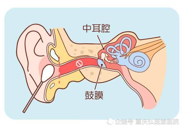 耳朵痛,耳朵流脓,耳朵听不见