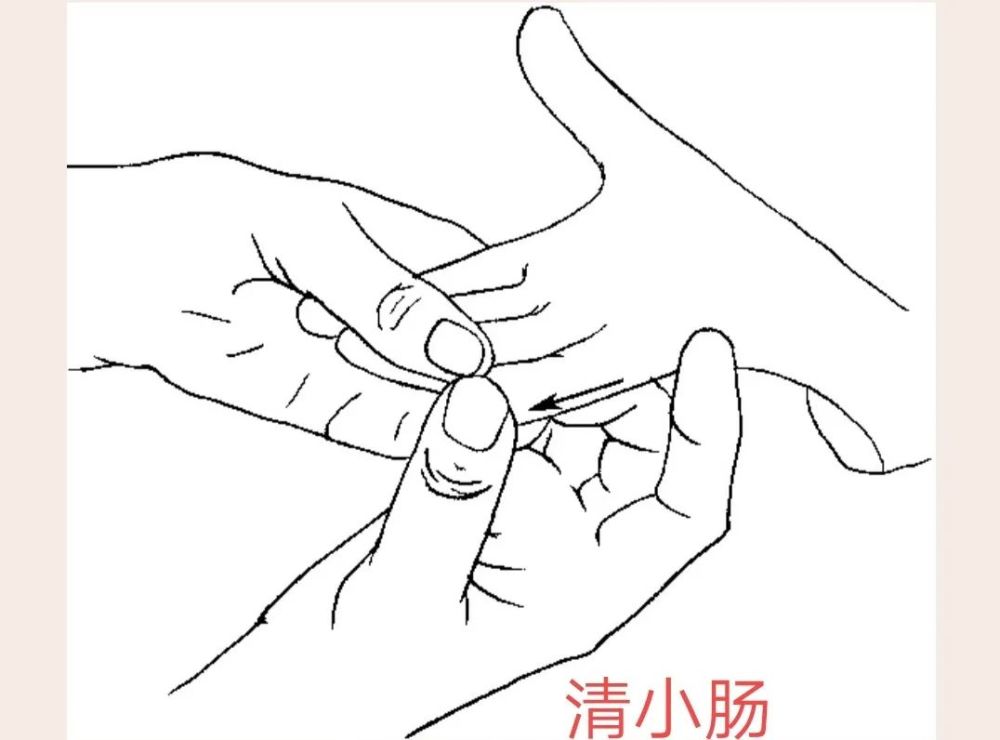 清小肠:家长用右手拇指面在小儿小指外侧缘从指根向指尖直线推动200