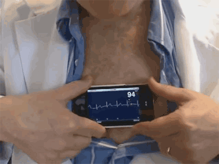 alivecor手机监测心率