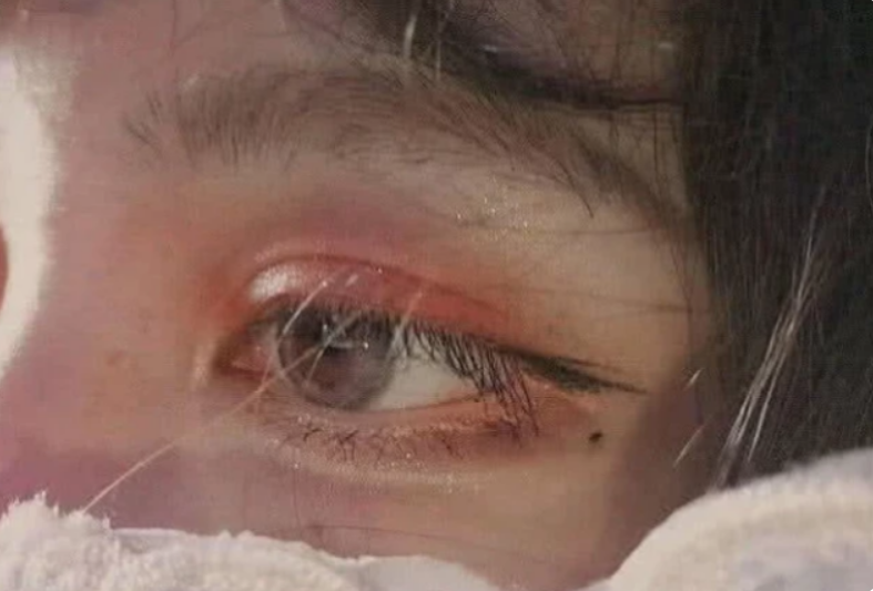 心理测试:选出你认为刚哭过的眼睛,暴露你是真聪明还是装聪明!
