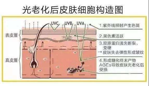 一篇带你了解抗衰学说——抗糖,抗自由基,抗光老化