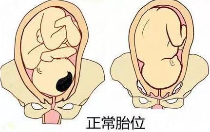 3,胎位不正 胎位会影响孕妈肚子的大小,其实一般来说,胎位在左枕前位