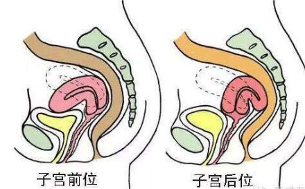 轻视这些子宫的"小问题",容易引起你的生育"大问题"