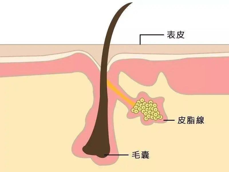 男生,皮脂