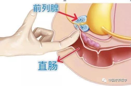 直肠,肛管,肛门,肛瘘,内痔,肿块