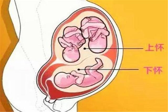 怀孕,上怀,下怀,胎儿