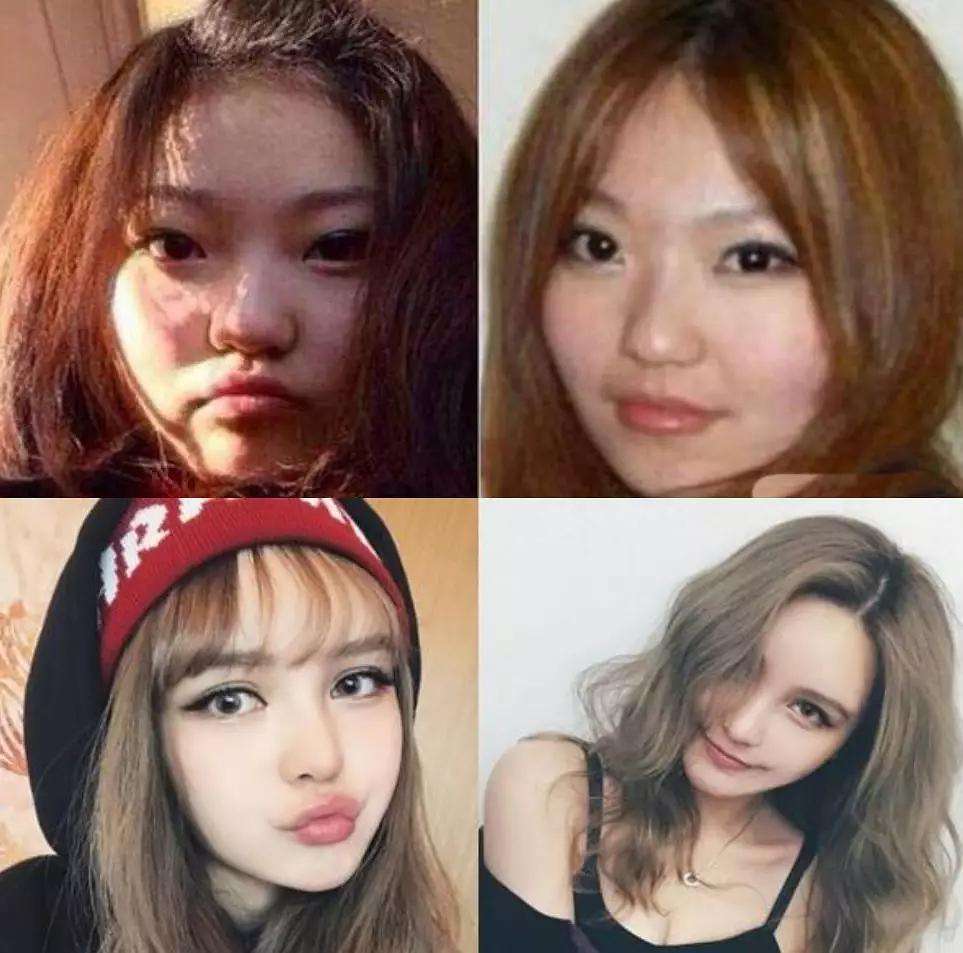 周扬青前后整容对比照,现在很漂亮,很有混血范儿,特别