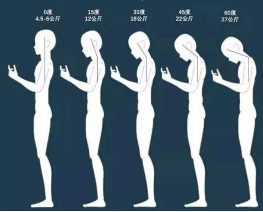 仿佛扛着一袋大米低头玩手机,年轻人你的颈椎还好吗?