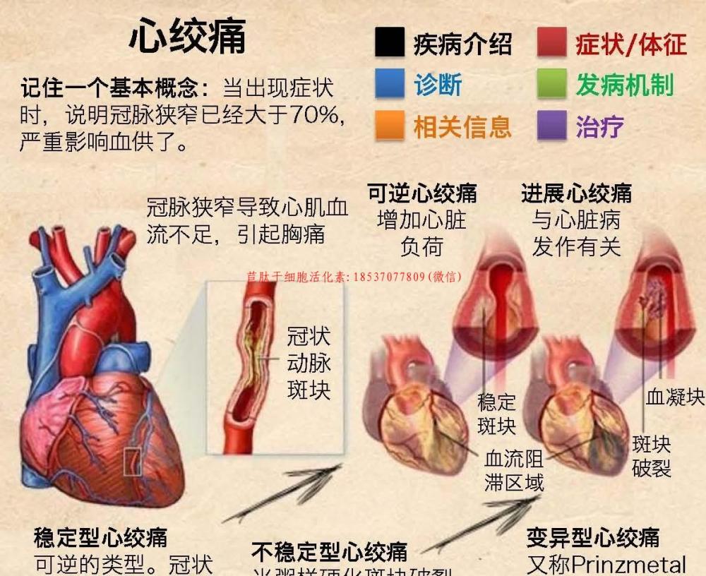 都是胸痛,心绞痛和心梗有什么区别?心梗是必须马上住院的